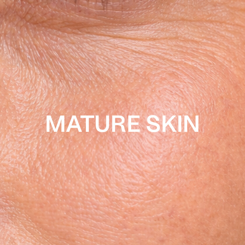 Ikääntyvä iho