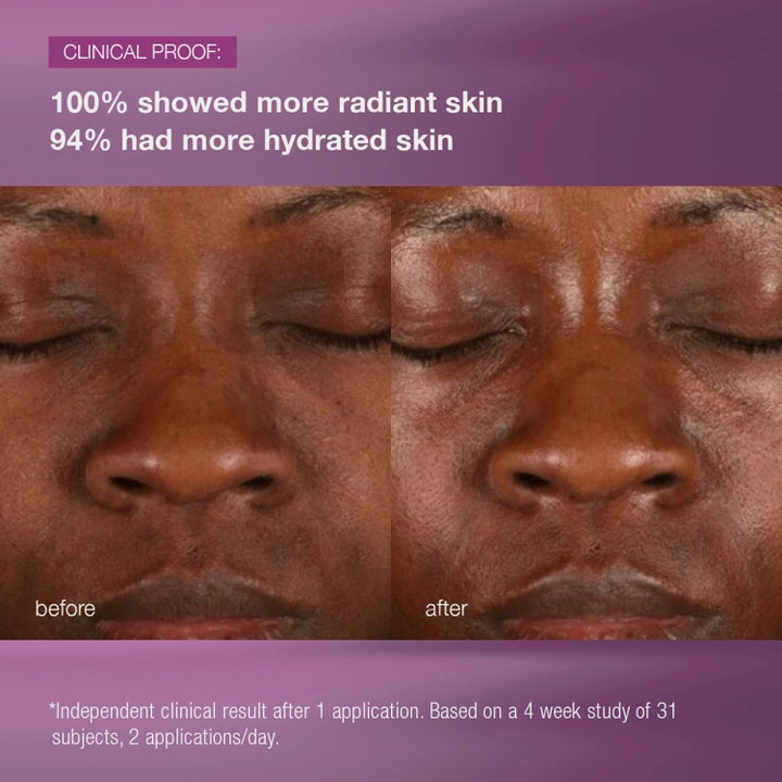 Dermalogica MultiVitamin Power Recovery Cream 50 ml elvyttävä yövoide ja kliiniset ennen ja jälkeen kuvat heleydestä.