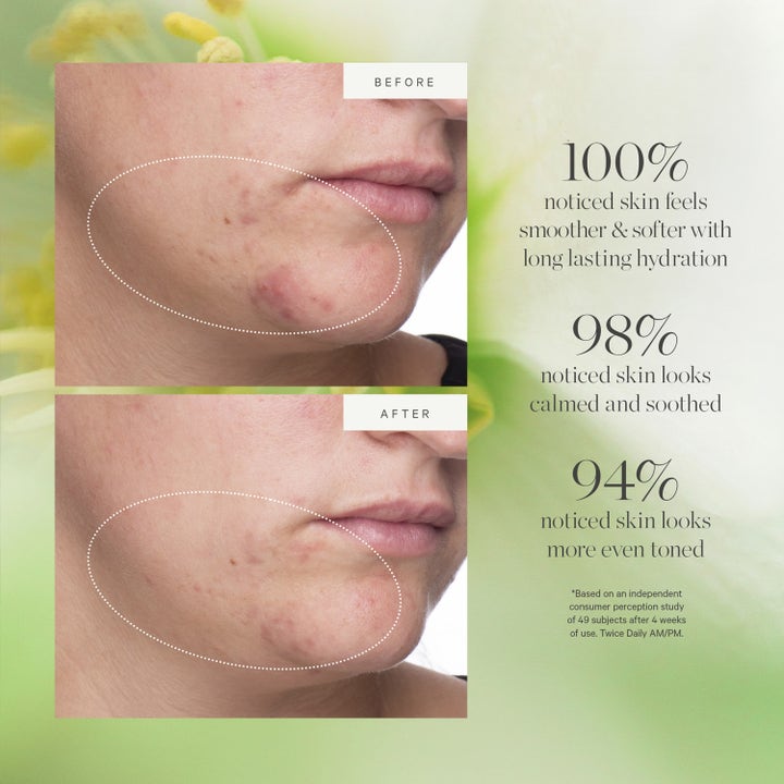 KORA Organics Active Algae Lightweight Moisturizer 50 ml kasvovoide ennen ja jälkeen iho silottuu ja pehmenee.