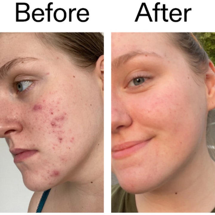 The INKEY List 15% Vitamin C and EGF Serum 30 ml kirkastava seerumi valkoisessa pullossa valuvan kirkkaan koostumuksen kera