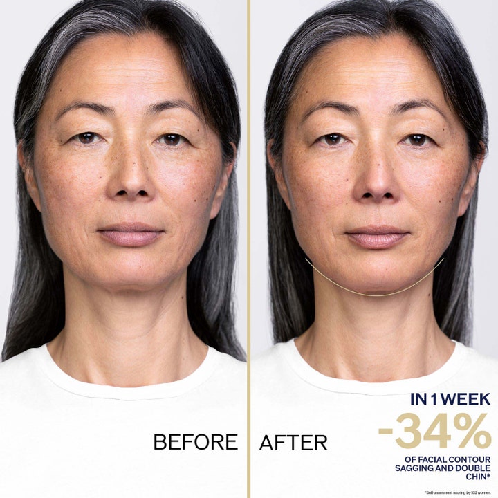 Shiseido Vital Perfection Overnight Firming Treatment 80 ml ennen ja jälkeen tulokset kiinteämmälle iholle.
