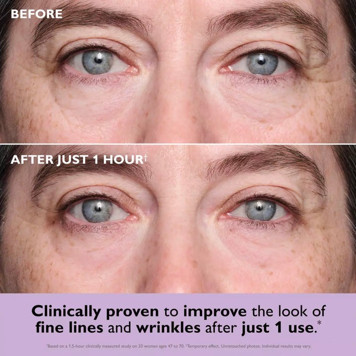 Peter Thomas Roth Instant FIRMx Collagen Eye Patches 8 kpl silmänympärysnaamiot silottavat juonteita näkyvästi tunnissa.