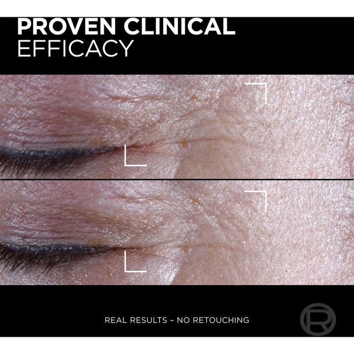 L'Oréal Paris Age Perfect Cell Renewal Midnight Eye Cream 15 ml silmänympärysvoide näyttää kliinisen tehon rypyille.