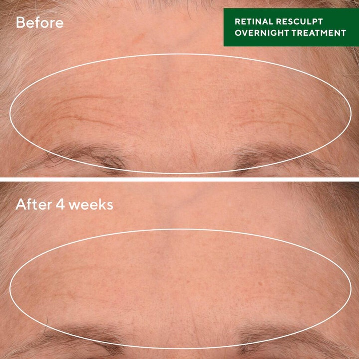 Murad Retinal ReSculpt Treatment 30 ml kiinteyttävä seerumi silottaa otsan juonteita neljän viikon käytön jälkeen