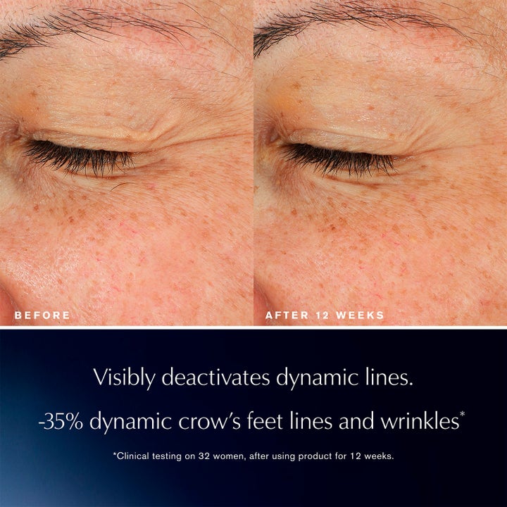 Estée Lauder Advanced Night Repair Eye Lift + Sculpt 15 ml silmänympärysseerumi ennen ja jälkeen kuvassa.