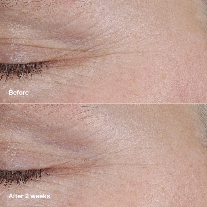 Retinoid & Hydration Repair Duo