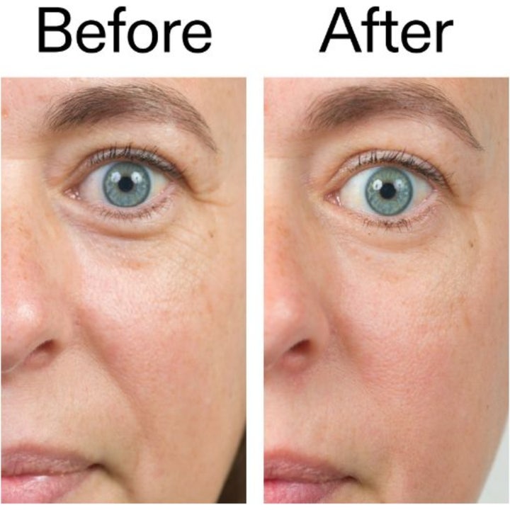 The INKEY List Bio-Active Ceramide Repairing and Plumping Moisturizer 50 ml ennen ja jälkeen tulos silottaa juonteita.