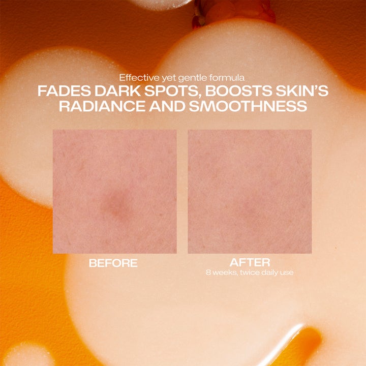 Lumene Dark Spot Serum 30 ml kirkastava seerumi häivyttää tummia läiskiä ja tasoittaa ihoa ennen ja jälkeen kuvassa