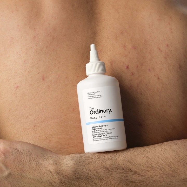 The Ordinary Salicylic Acid 0.5% Body Serum 240 ml hoitaa epäpuhtauksia valkoisessa pullossa kapealla kärjellä.