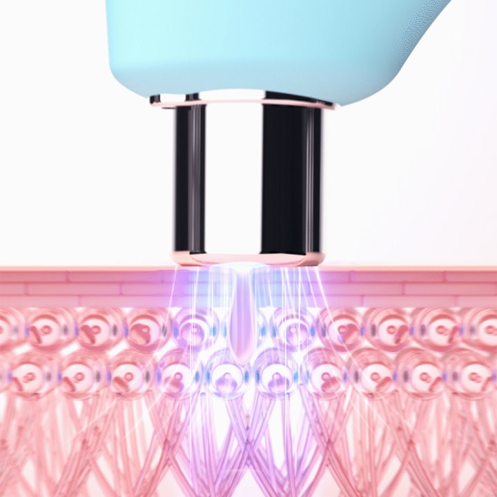 FOREO KIWI 1 kpl syväpuhdistava ihonhoitolaite poistaa epäpuhtauksia violetilla valolla ihohuokosista.