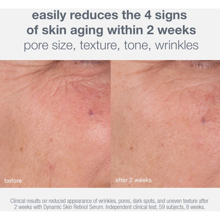 Dermalogica Skin Aging Solutions 70 ml seerumi vähentää ryppyjä ja ihohuokosia kahden viikon käytön jälkeen