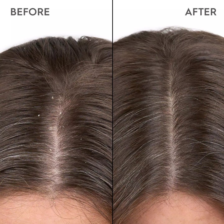 Kerasilk Anti-Dandruff Scalp Serum 100ml