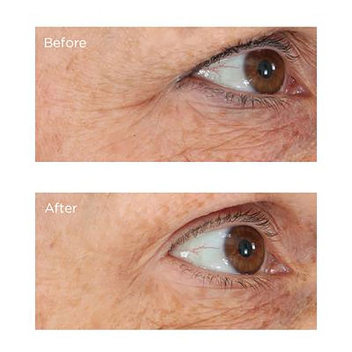 Essential Fx Acyl-Glutathione
