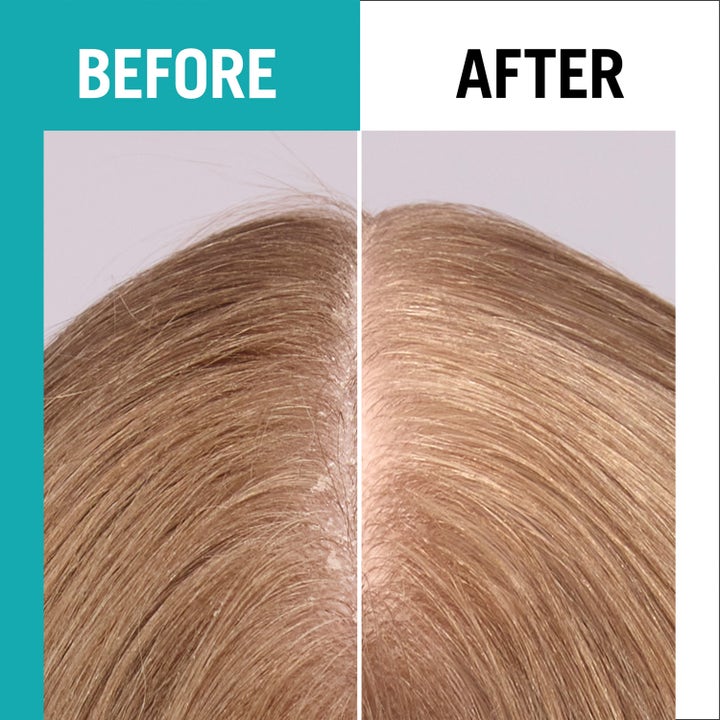 Gliss Scalp Balance Hydrating Serum