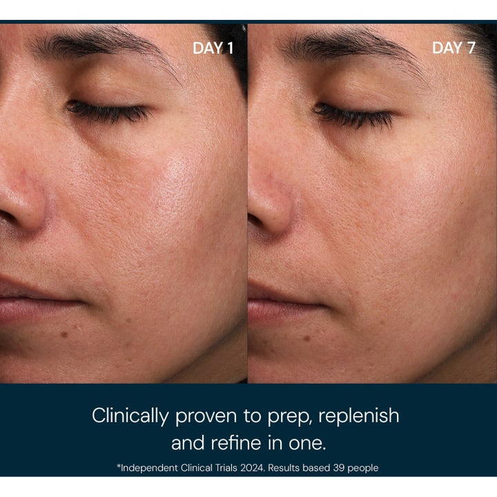 Elemis Pro-Collagen Toning Mist 150 ml kasvovesi ennen ja jälkeen -kuvassa silottaa ihoa 7 päivässä.