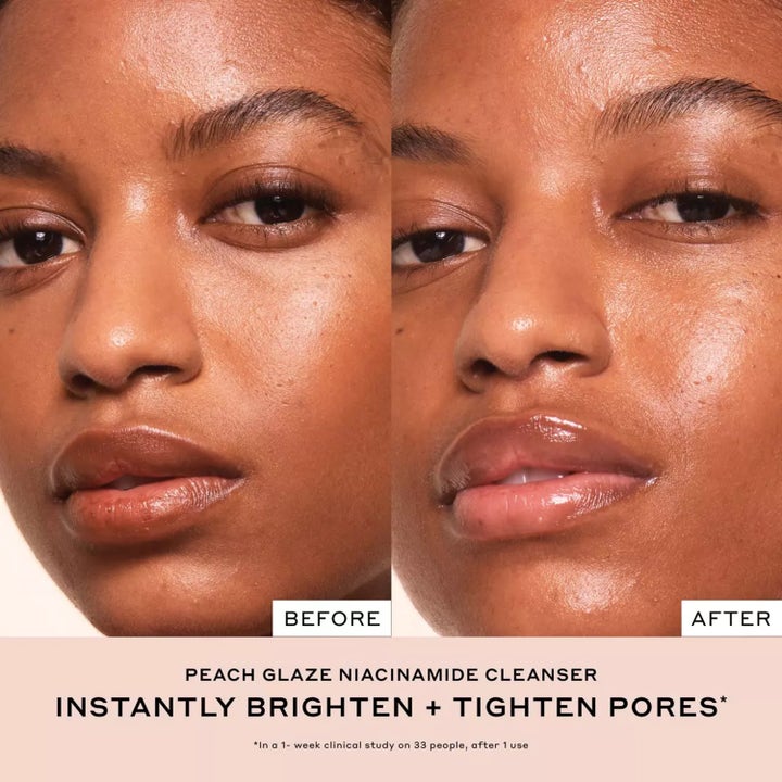 Ole Henriksen Truth Peach Cleanser 148 ml kirkastava puhdistusgeeli ennen ja jälkeen kuva ihohuokosista.