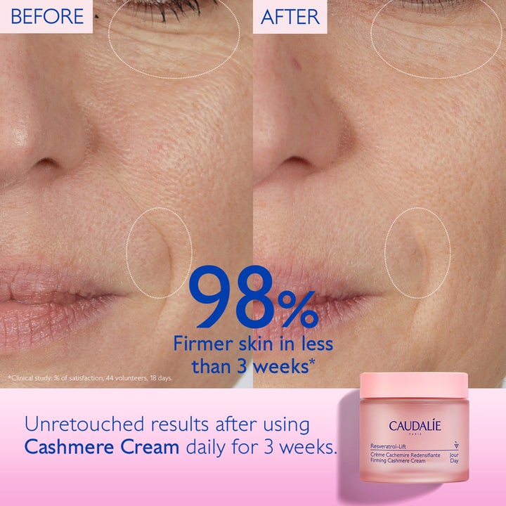 Caudalie Resveratrol-Lift Firming Cashmere Cream 50 ml kiinteyttävä päivävoide ennen ja jälkeen -tulokset iholla.