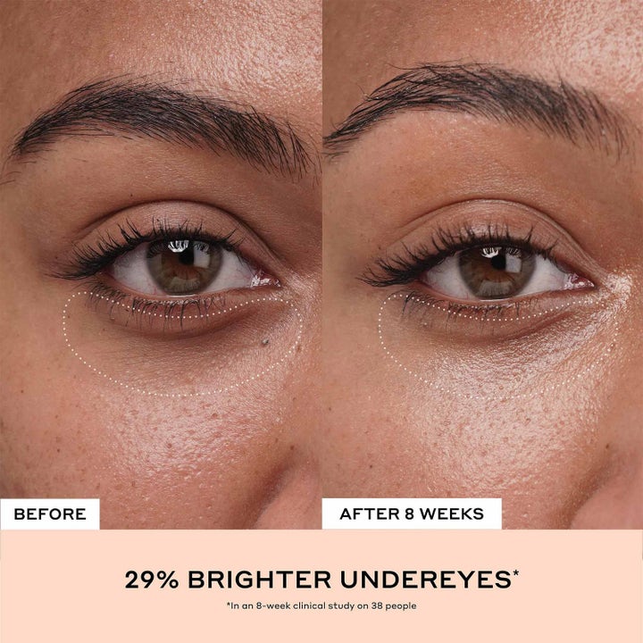 Ole Henriksen Truth Banana Bright + Eye Crème 15 ml kirkastava silmänympärysvoide ja 29 % kirkkaampi iho ennen ja jälkeen.
