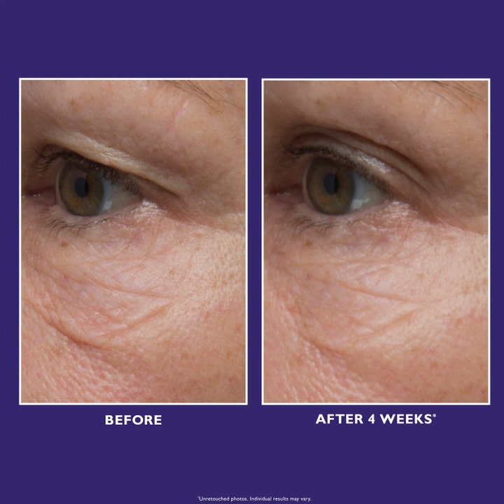 Peter Thomas Roth Ultimate Solution 5™ Eye Cream 15 ml silottaa ryppyjä 4 viikon käytön jälkeen.