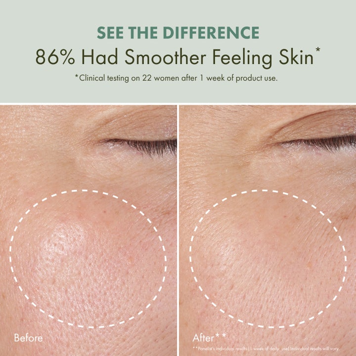 Origins Checks and Balances Daily Exfoliating Toner 150 ml kuoriva kasvovesi silottaa ihoa ennen ja jälkeen kuvassa