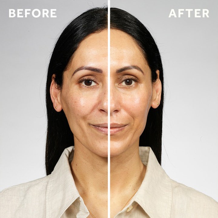 No7 Pure Retinol Triple Action Day Cream 100 ml kiinteyttävä päivävoide ennen ja jälkeen -tulos tasaisemmalle iholle.