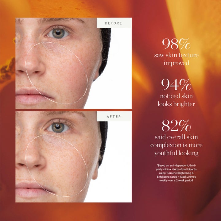 KORA Organics Turmeric Brightening & Exfoliating Scrub & Mask 30 ml kirkastava kuorinta ja ennen ja jälkeen kuvat.