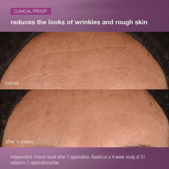 Dermalogica MultiVitamin Power Recovery Cream 50 ml yövoide vähentää ryppyjä ennen ja jälkeen 4 viikon käytön.