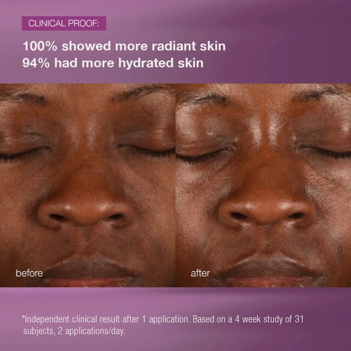 Dermalogica MultiVitamin Power Recovery Cream Duo heleyttävä voide ennen ja jälkeen tulos kosteutetusta ihosta.