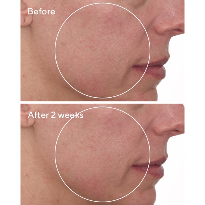 Murad Cellular Hydration Repair Cream 50 ml kosteuttava kasvovoide ennen ja jälkeen tulokset kahden viikon käytöstä