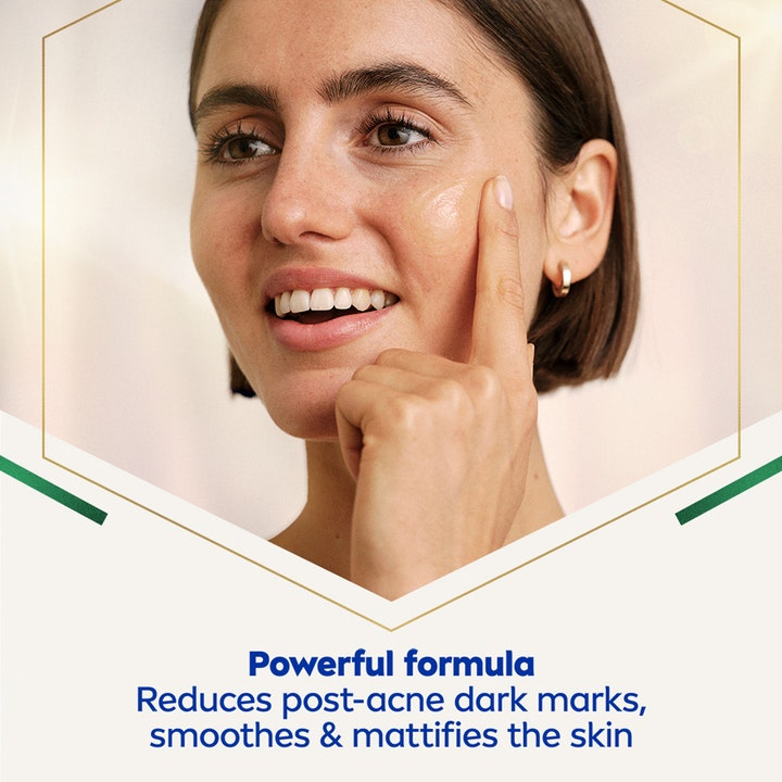 NIVEA LUMINOUS 630 Post-Acne Marks Serum 30 ml vähentää aknejälkiä ja mattaistaa ihoa nainen levittää seerumia