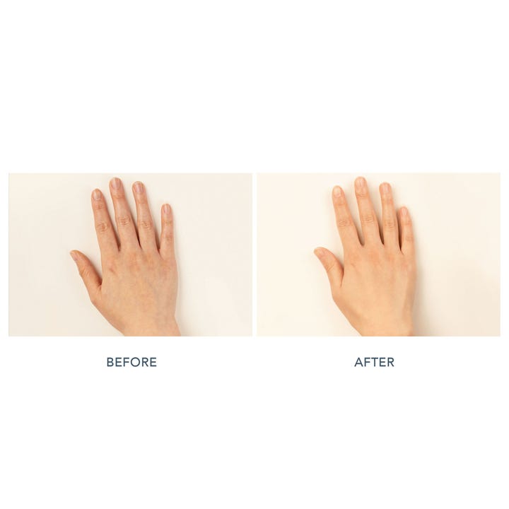FAQ Swiss FAQ 221 LED Hand Mask 1 kpl ennen ja jälkeen vertailukuva tasaisemmasta ihon sävystä.