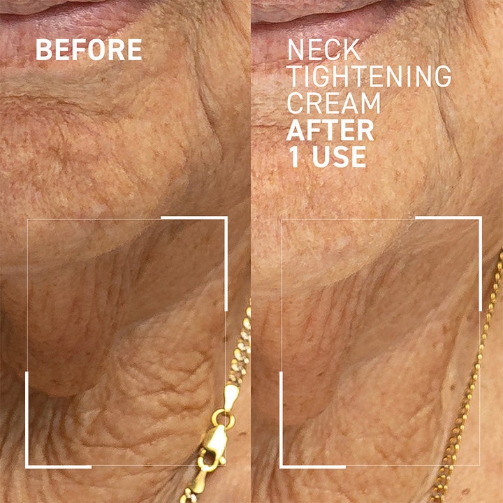 Dr Brandt Neck Tightening Cream 50 g kiinteyttävä kaulavoide ennen ja jälkeen -tulokset yhdellä käytöllä