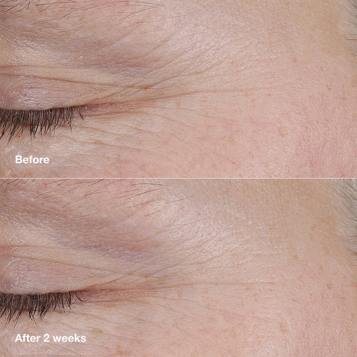 Clinique Smart Clinical Repair 3 g silmänympärysvoide häivyttää juonteita ennen ja jälkeen kuvassa.
