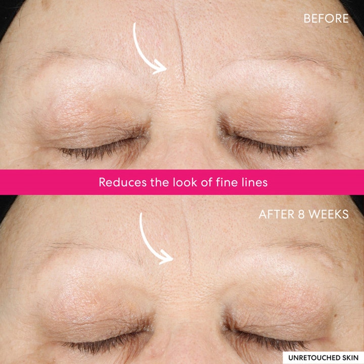 bareMinerals Ageless Phyto-AHA Radiance Facial 50 ml seerumi vähentää hienoja juonteita ennen ja jälkeen kuvissa.