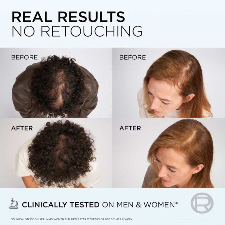 Hair Restoration Trio