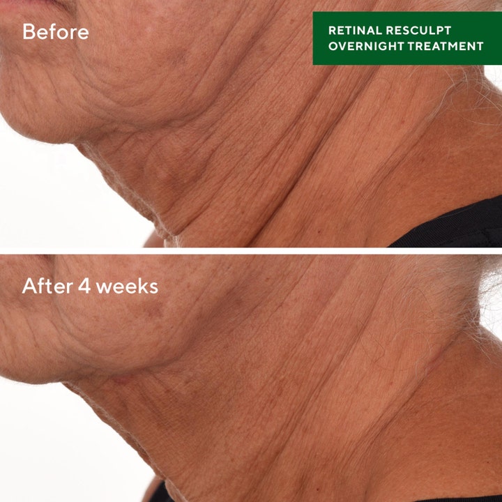 Murad Retinal ReSculpt Treatment 30 ml kiinteyttävä seerumi silottaa kaulan ryppyjä neljässä viikossa.