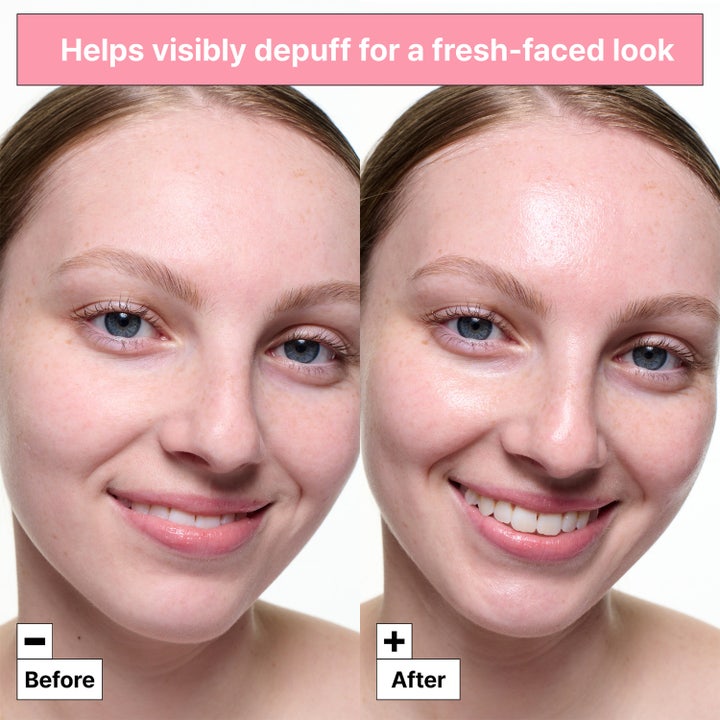 Dr.Jart+ Cryo Sorbet Icy Facial Mask 3 g virkistävä kasvonaamio vähentää turvotusta ennen ja jälkeen -vertailussa.