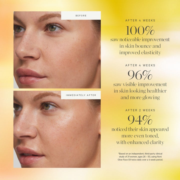 KORA Organics Noni Glow Face Oil 30 ml kasvoöljy antaa hehkua ja kimmoisuutta, ennen ja jälkeen -kuvat ja tulokset.
