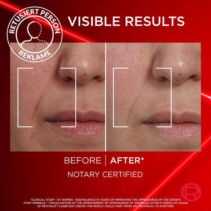 L'Oréal Paris Laser Advance Anti-Ageing Care Day 50 ml kiinteyttävä päivävoide ja kliinisesti todistetut tulokset iholla