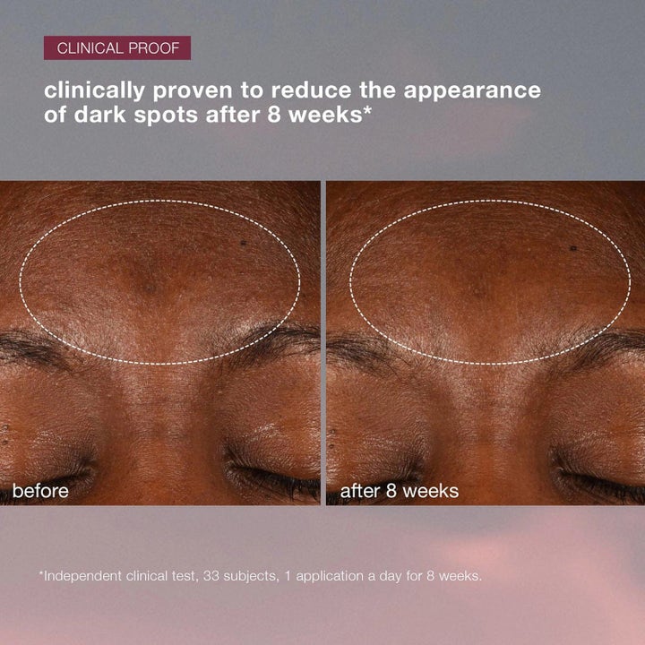 Dermalogica AGE smart Dynamic Skin Recovery SPF50 ennen ja jälkeen kuvat häivyttävät tummia läiskiä.