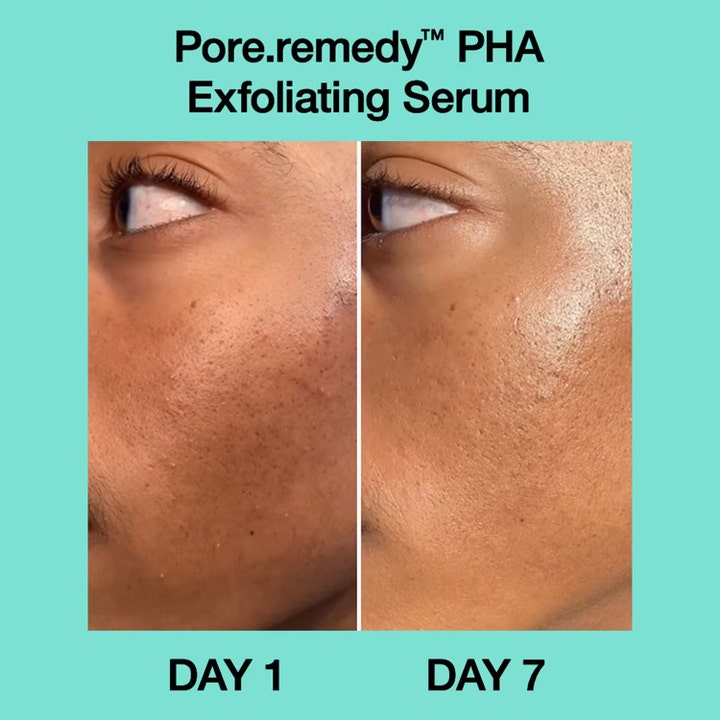 Dr.Jart+ Pore-remedy PHA Exfoliating Serum 30 ml kuoriva seerumi tasoittaa ihon rakennetta