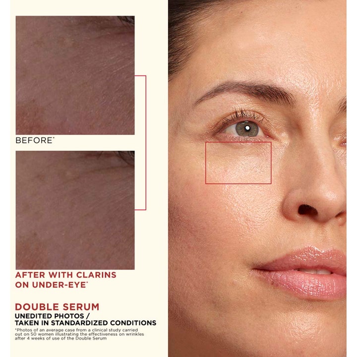 Clarins Double Serum 30 ml silmänympärysiholle silottaa juonteita ennen ja jälkeen kuvissa.
