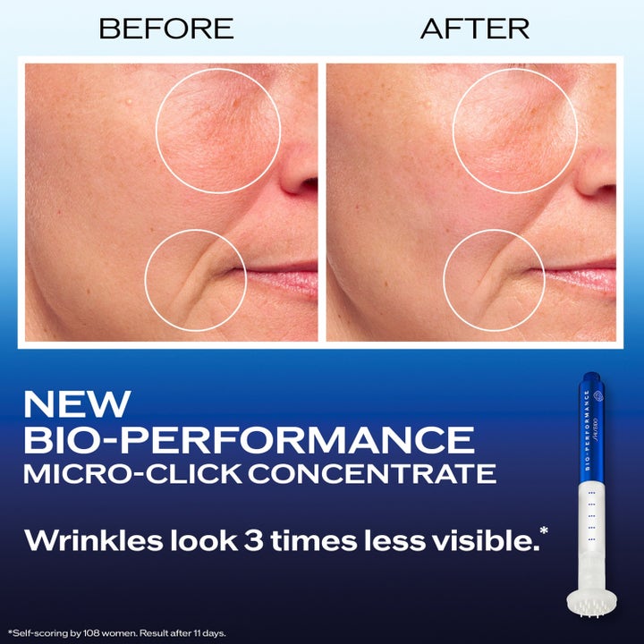 Shiseido Bio Performance 2.0 Micro Needle 1,4 ml täsmähoito ja ennen ja jälkeen -kuvat ryppyjen silottumisesta.