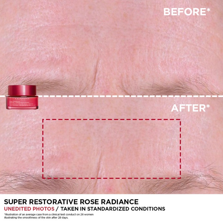 Clarins Rose Radiance Super Restorative 50 ml silottava päivävoide ennen ja jälkeen tulokset otsan iholla.