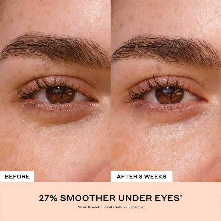 Ole Henriksen Truth Banana Bright + Eye Crème 15 ml kirkastava voide silottaa ihoa 27 % 8 viikon käytön jälkeen.