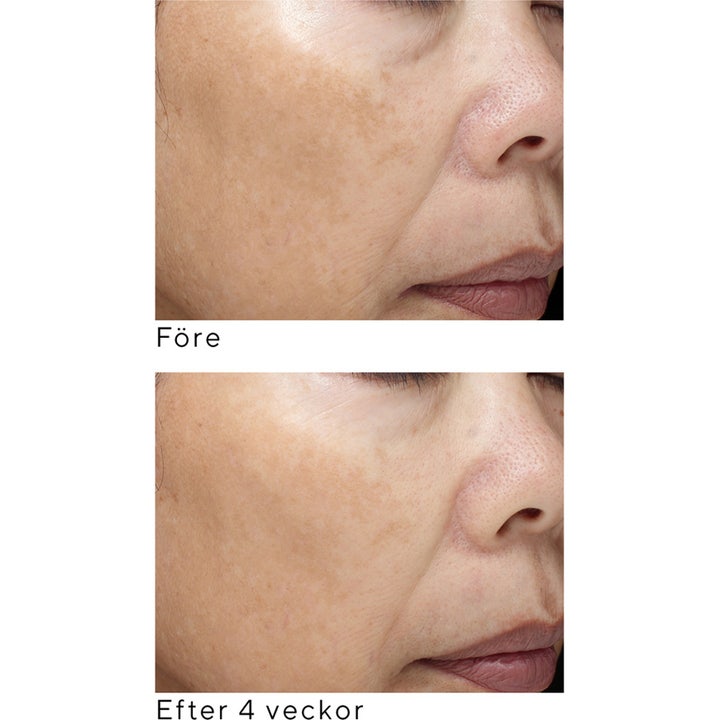 Murad Essential-C Firming Radiance Day Cream 50 ml kirkastava päivävoide ennen ja jälkeen tulokset 4 viikossa.