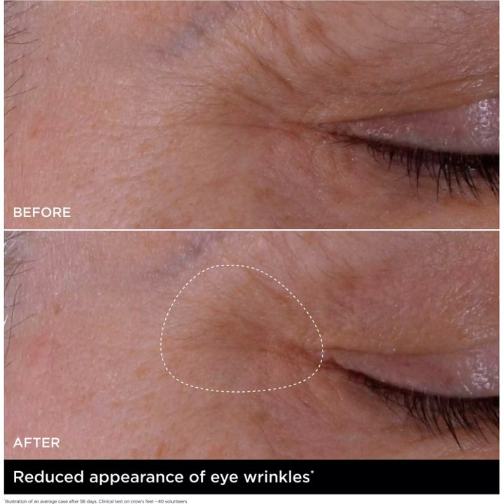 Double Serum Eye