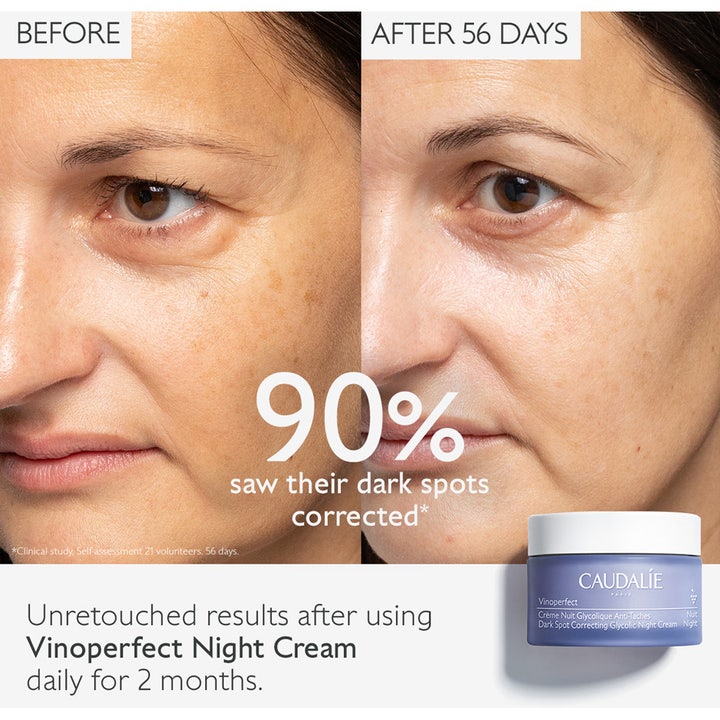 Caudalie Vinoperfect Night Cream 50 ml yövoide häivyttää pigmenttiläiskiä ennen ja jälkeen -tuloskuvassa.