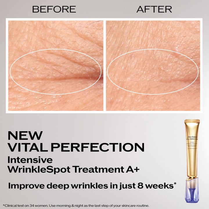 Shiseido Vital Perfection Intensive Wrinklespot Treatment A+ 20 ml täsmähoito silottaa ryppyjä ennen ja jälkeen.