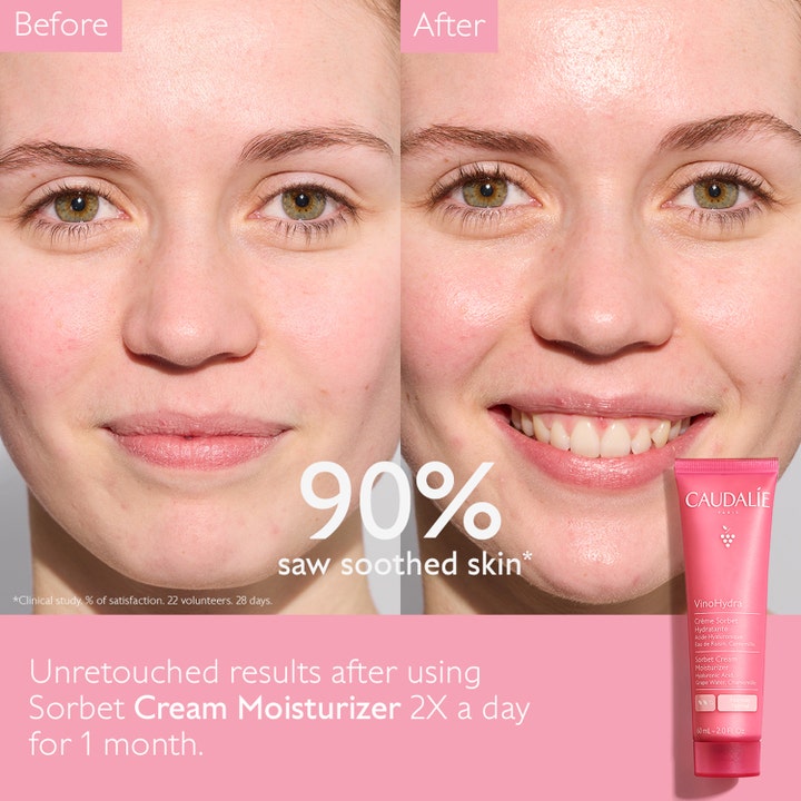 Caudalie Vinohydra Sorbet Cream 60 ml rauhoittava kasvovoide ennen ja jälkeen tulokset sekä pinkki tuubi